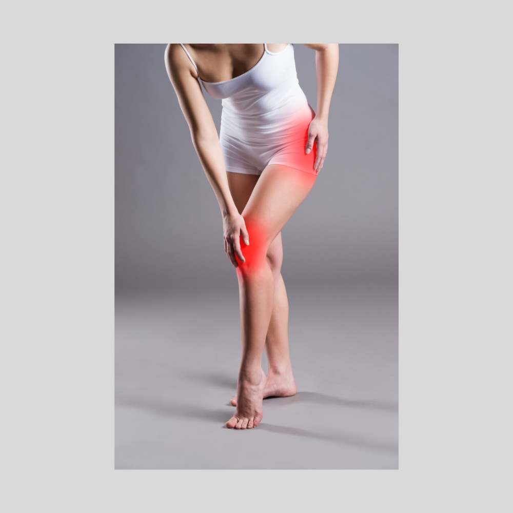 Painful varicose and spider veins on active womans legs, self-helping herself in overcoming the